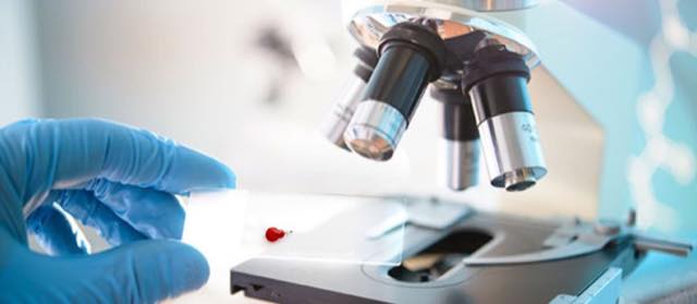 Live Blood Analysis